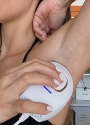 chica depilando su axila con depilador laser blanco